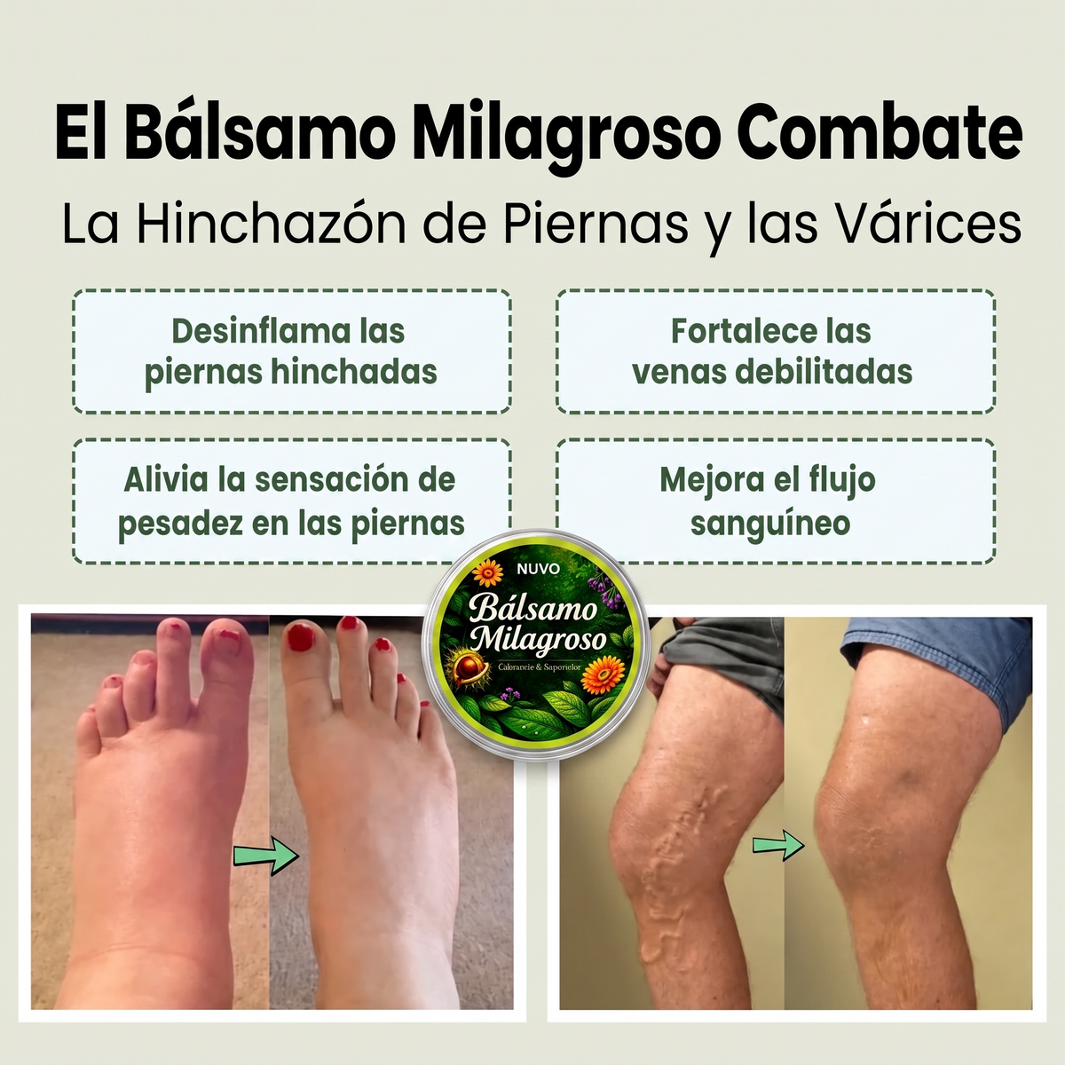 Bálsamo Milagroso | Efecto Frío para Piernas Cansadas Hecho en Argentina