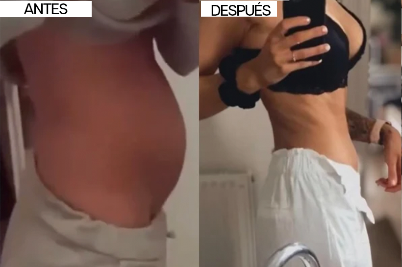 Carla B. · 45 años